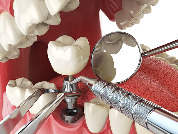 Best Weekend Emergency Dental Services in Bayou Lourse, LA